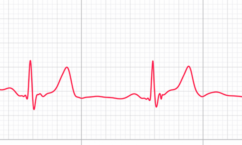 كيفية مشاركة مخطط كهربية القلب على Apple Watch مع الطبيب

