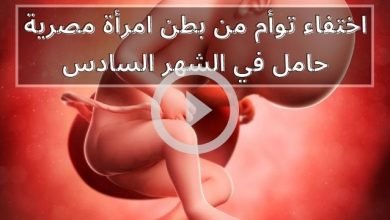 اختفاء توأم من بطن امرأة مصرية حامل في الشهر السادس